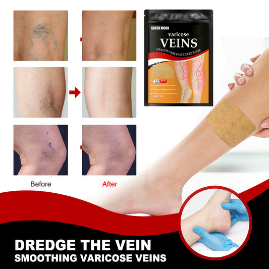 Varicose Vein Health Patch relieves varicose blood vessels in the feet alfamoba