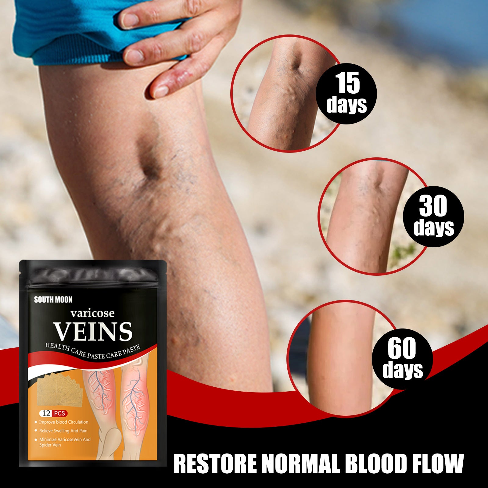 Varicose Vein Health Patch relieves varicose blood vessels in the feet alfamoba