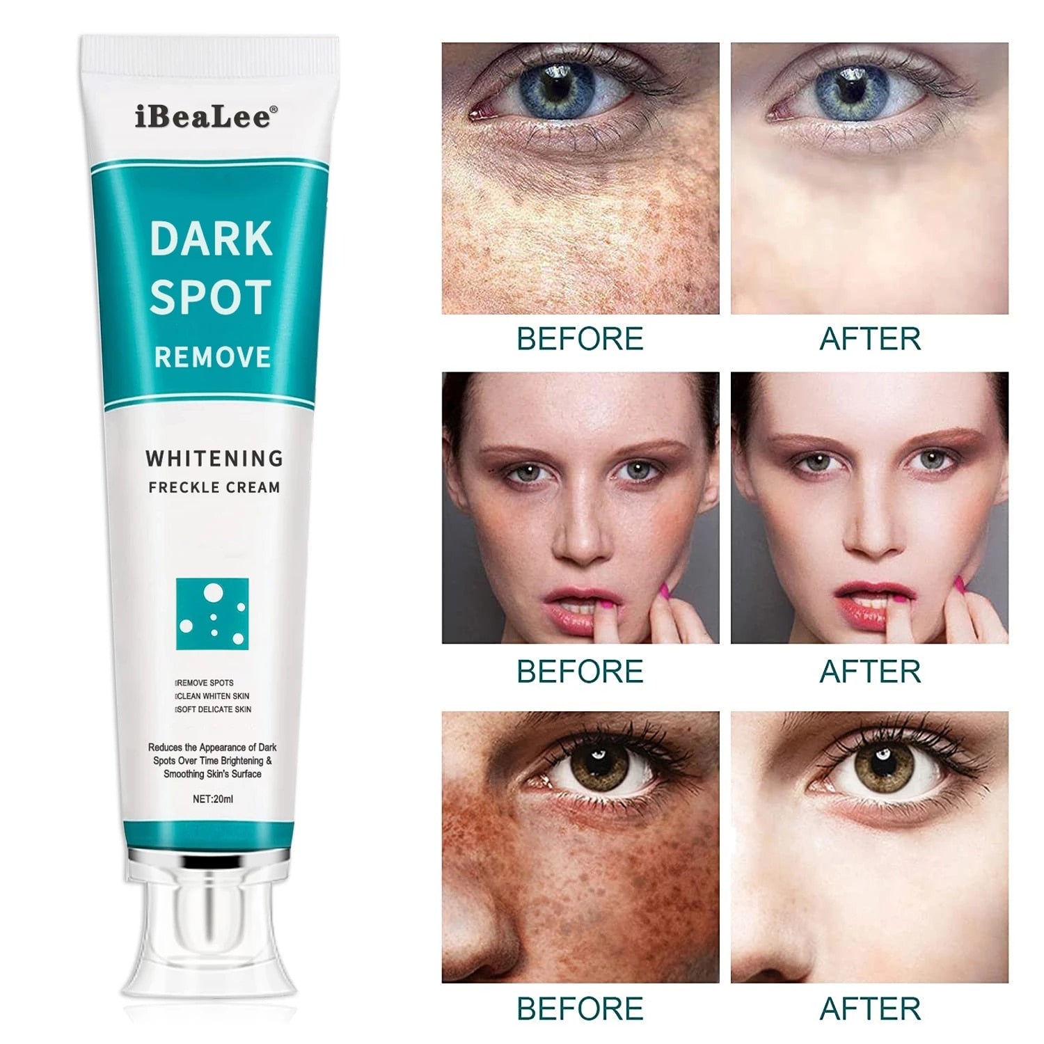 iBeaLee Whitening Freckle Cream Remove Melasma Acne Spot Pigment Melanin Dark Spots Whitening Moisturizing Cream Skin Care alfredo.barrella7